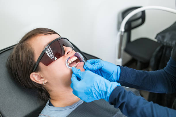Best Emergency Root Canal Treatment in Germantown, MD